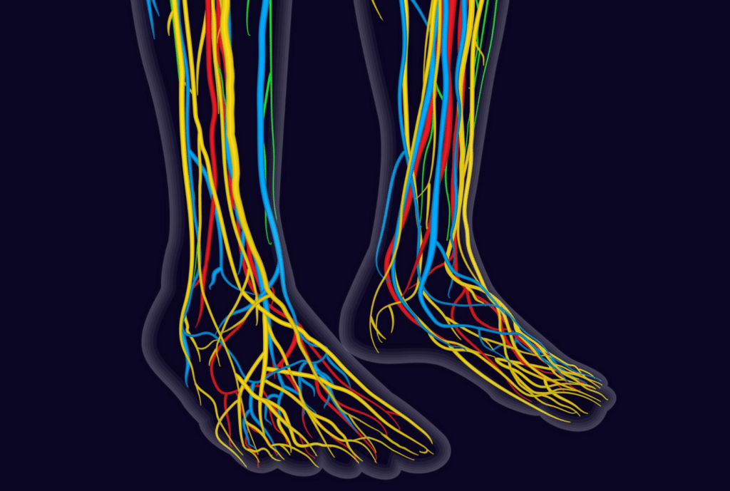 Illustration of damaged nerves discussed by Dr. Rob Neuenschwander at Neu Life Chiropractic in Tomball, TX